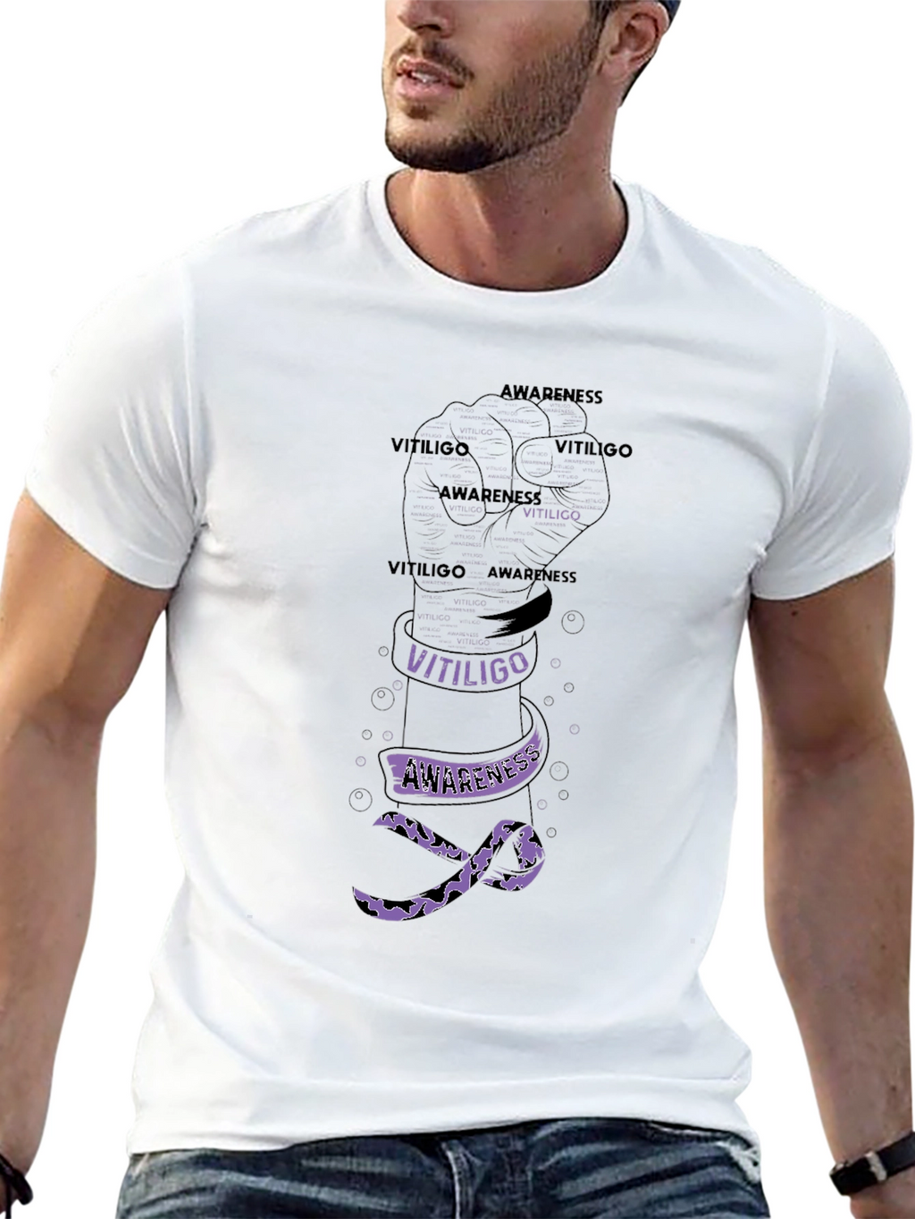 Vitiligo Awareness Fist T-Shirt